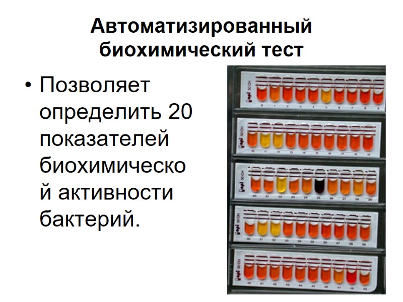 Автоматизированный биохимический тест  Позволяет определить 20 показателей биохимической активности бактерий.